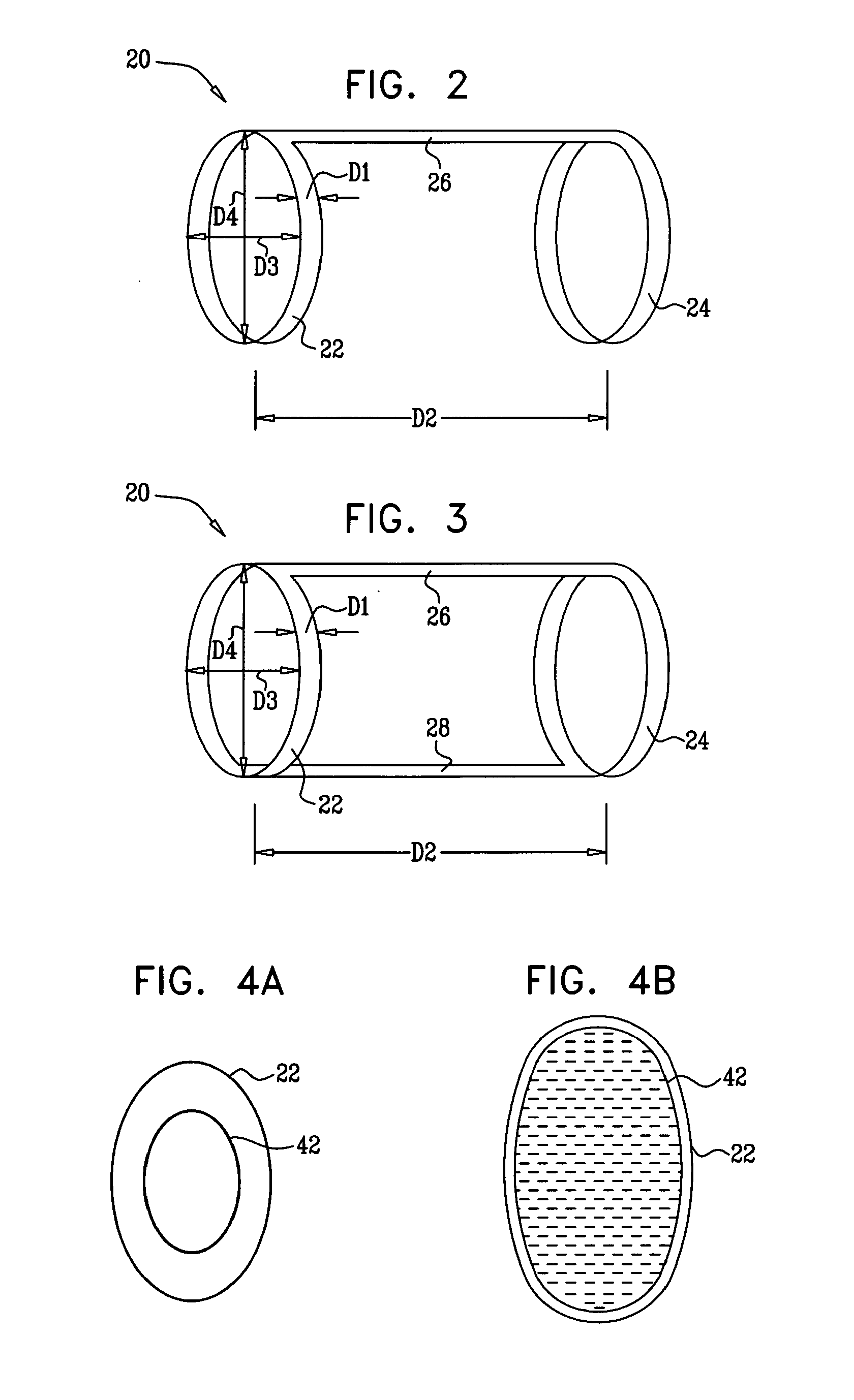 Elliptical element for blood pressure reduction