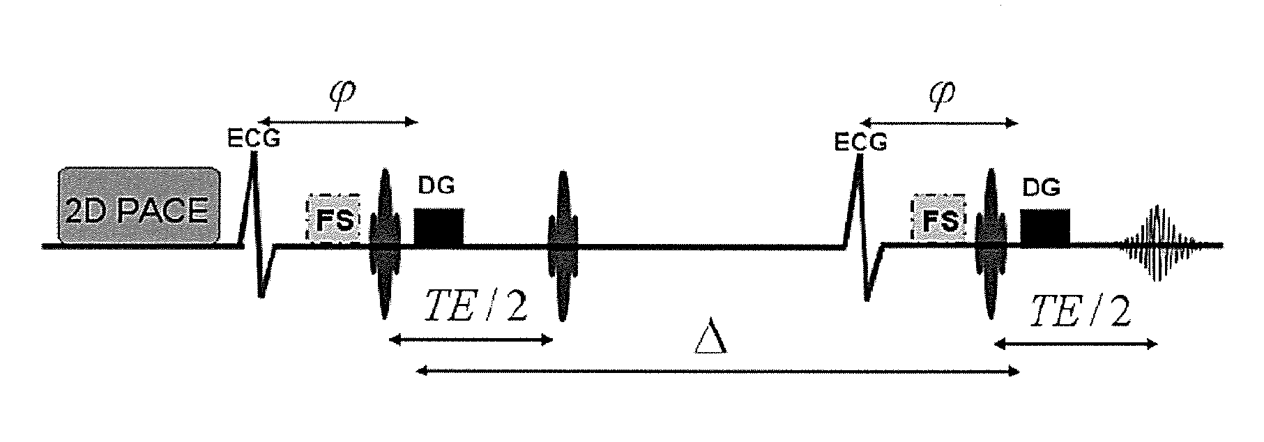 Diffusion tensor magnetic resonance imaging method