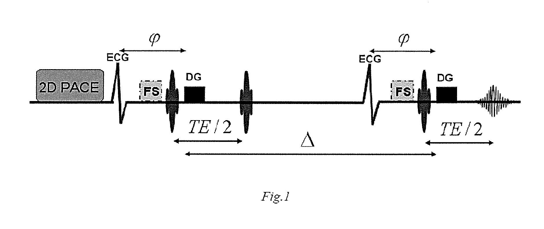 Diffusion tensor magnetic resonance imaging method