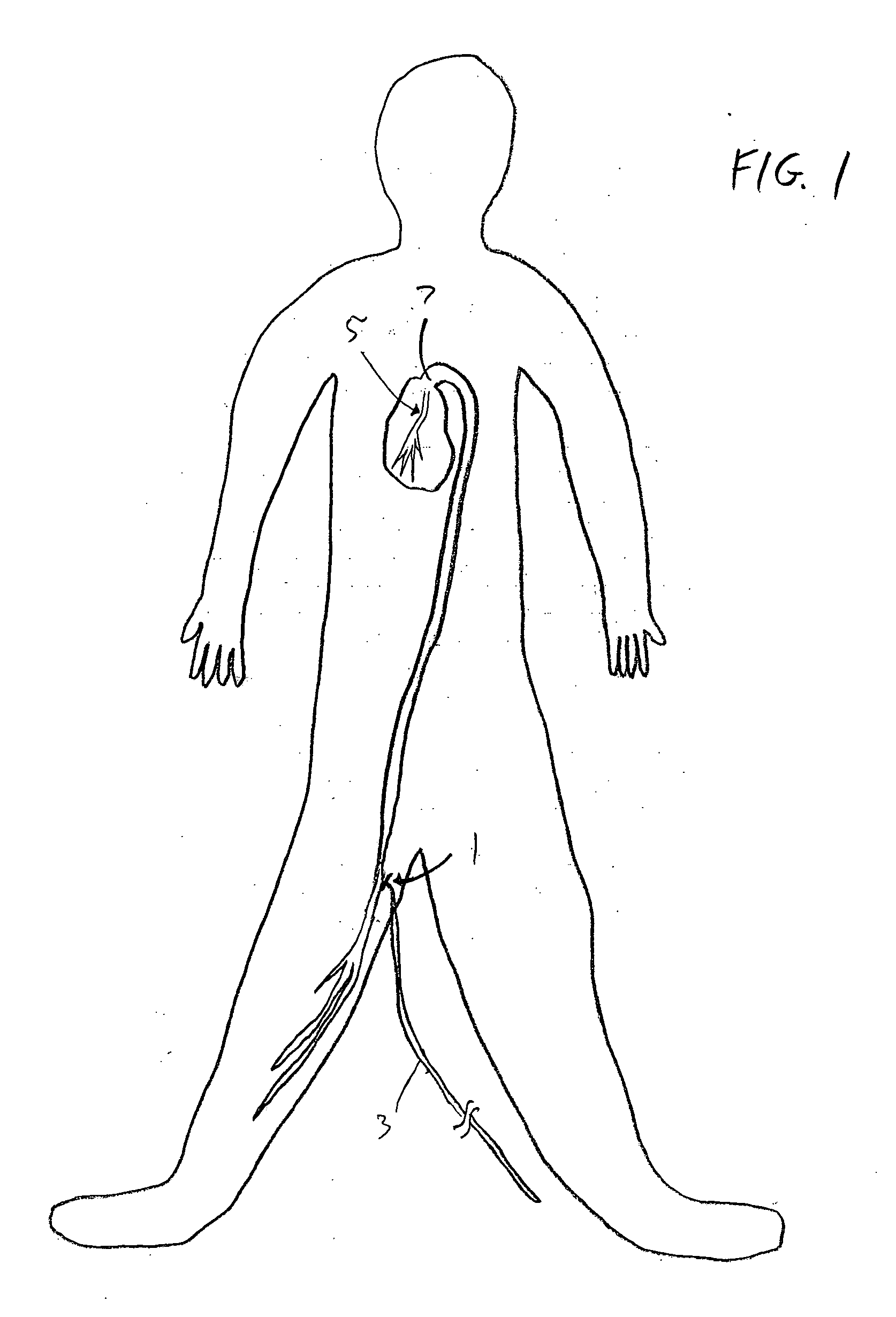 Computer-assisted manipulation of catheters and guide wires