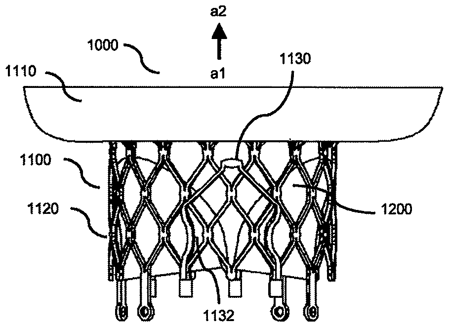 Heart valve prosthesis with clamping devices