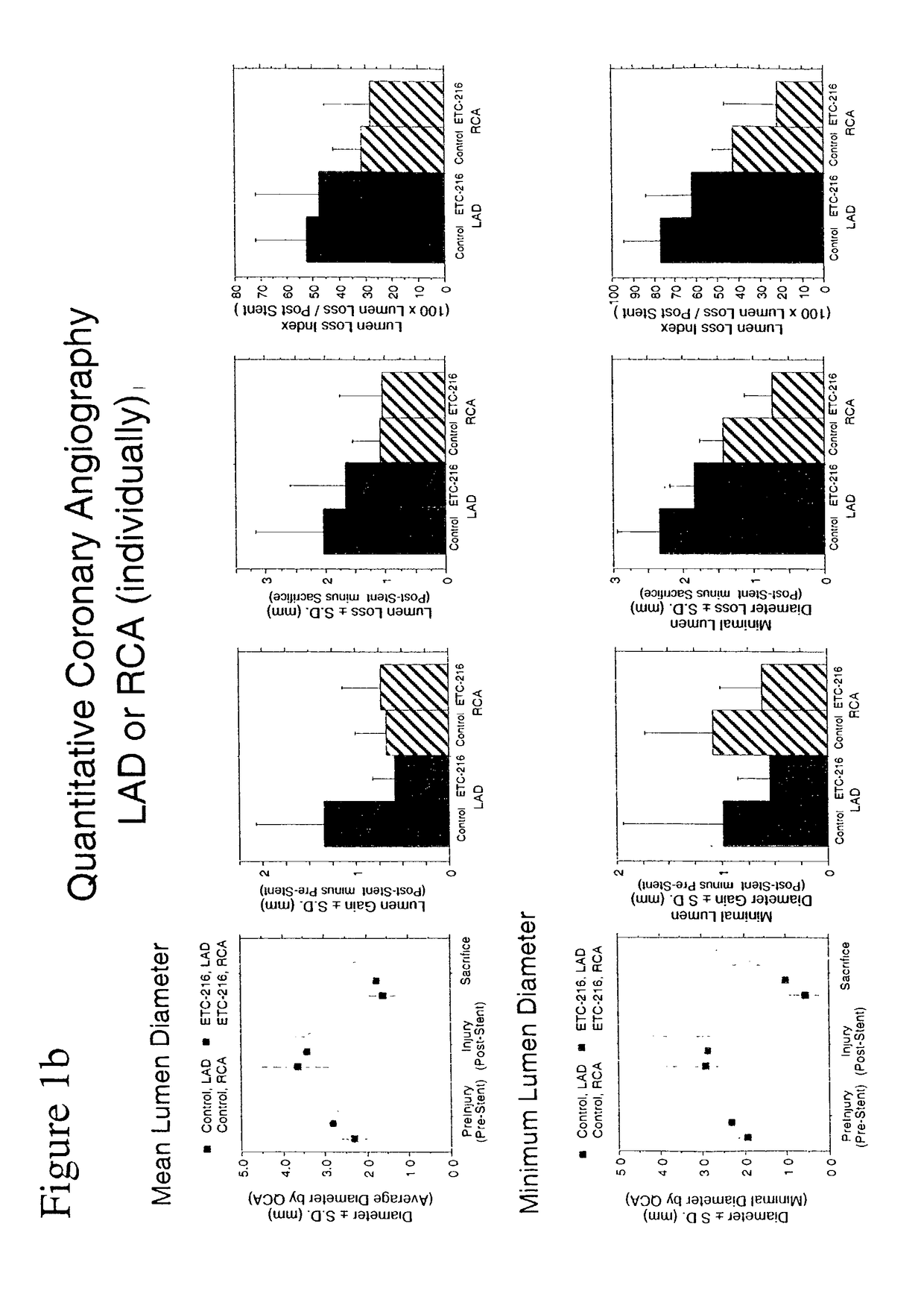 Prevention and treatment of restenosis by local administration of drug