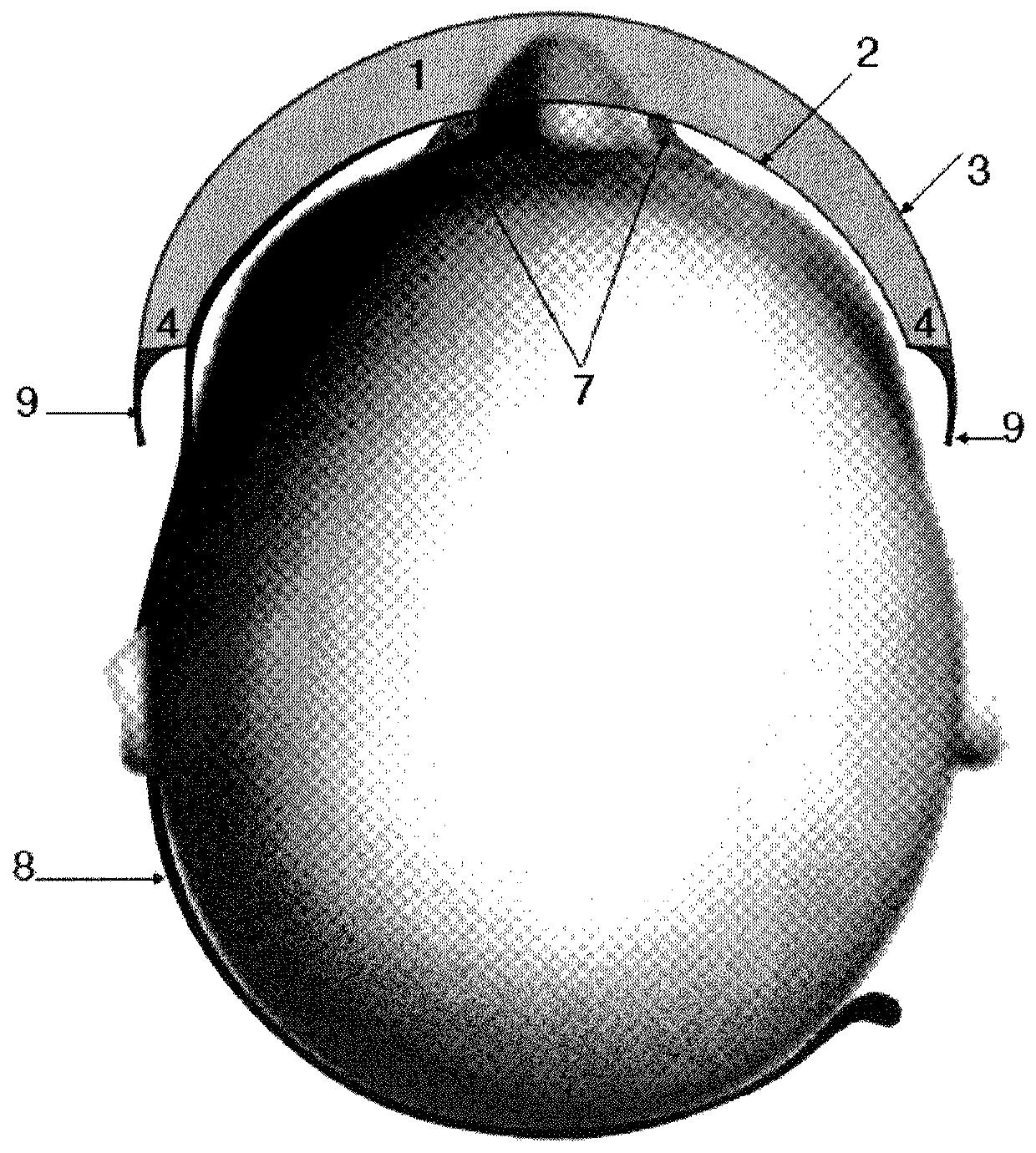 Structured barrier-exhaust-type medical mask with support