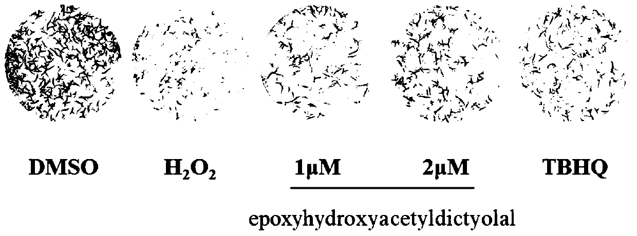 Application of xenicane type diterpenoid compound to preparation of antioxidative neuroprotective drugs