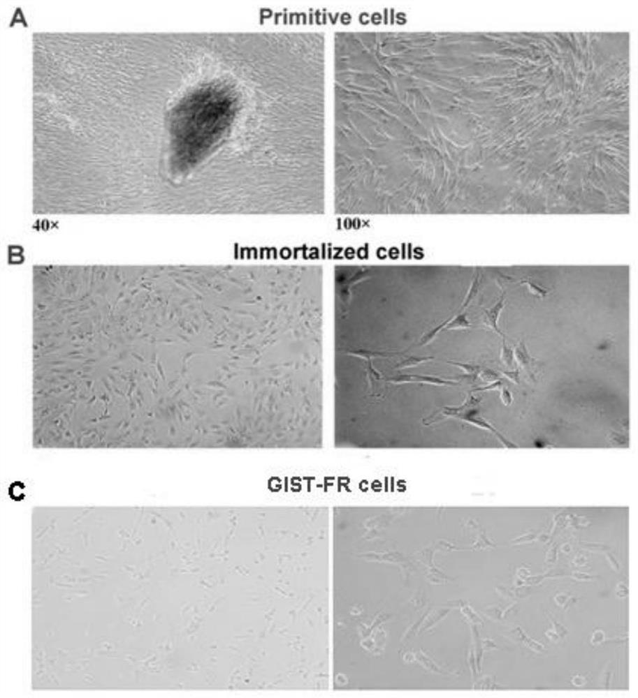 Imatinib-resistant kit and pdgfra wild-type gist cell lines and their construction methods and applications