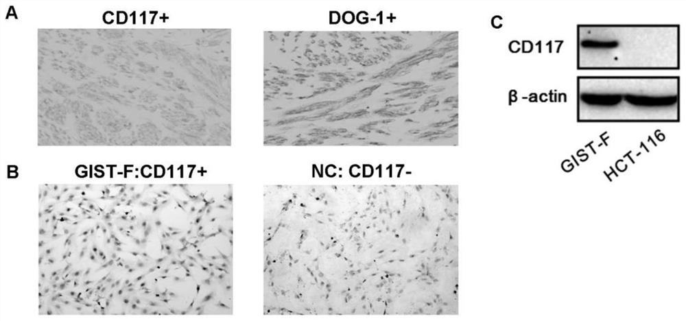 Imatinib-resistant kit and pdgfra wild-type gist cell lines and their construction methods and applications