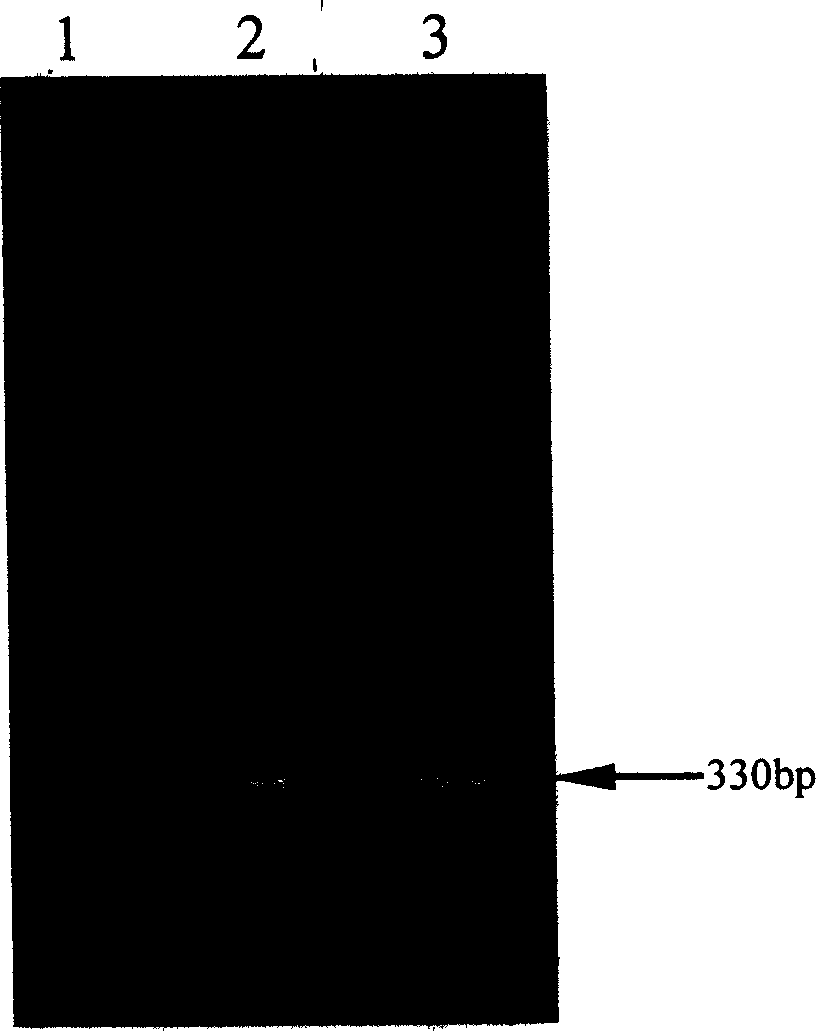 Prothoracic gland hormone gene of calf of milk cow and its cloning method and use