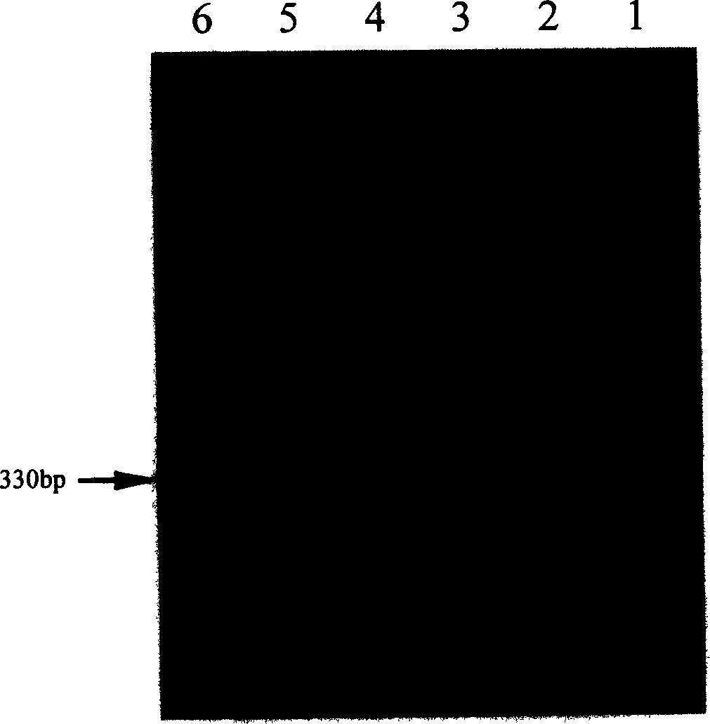 Prothoracic gland hormone gene of calf of milk cow and its cloning method and use