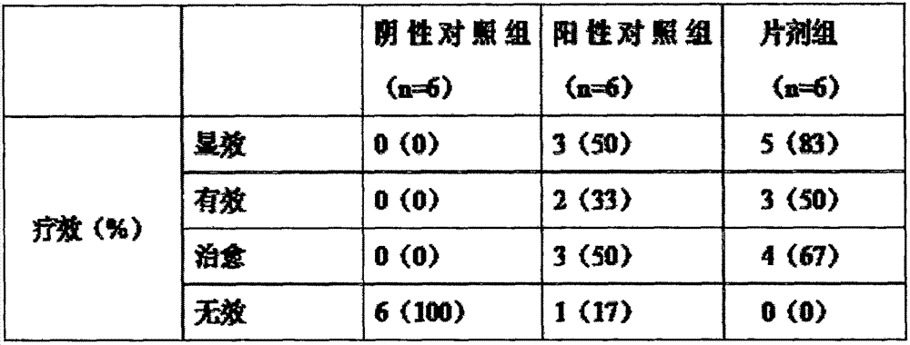 Medicine composition for treating congestive heart-failure and tablet and preparation method thereof