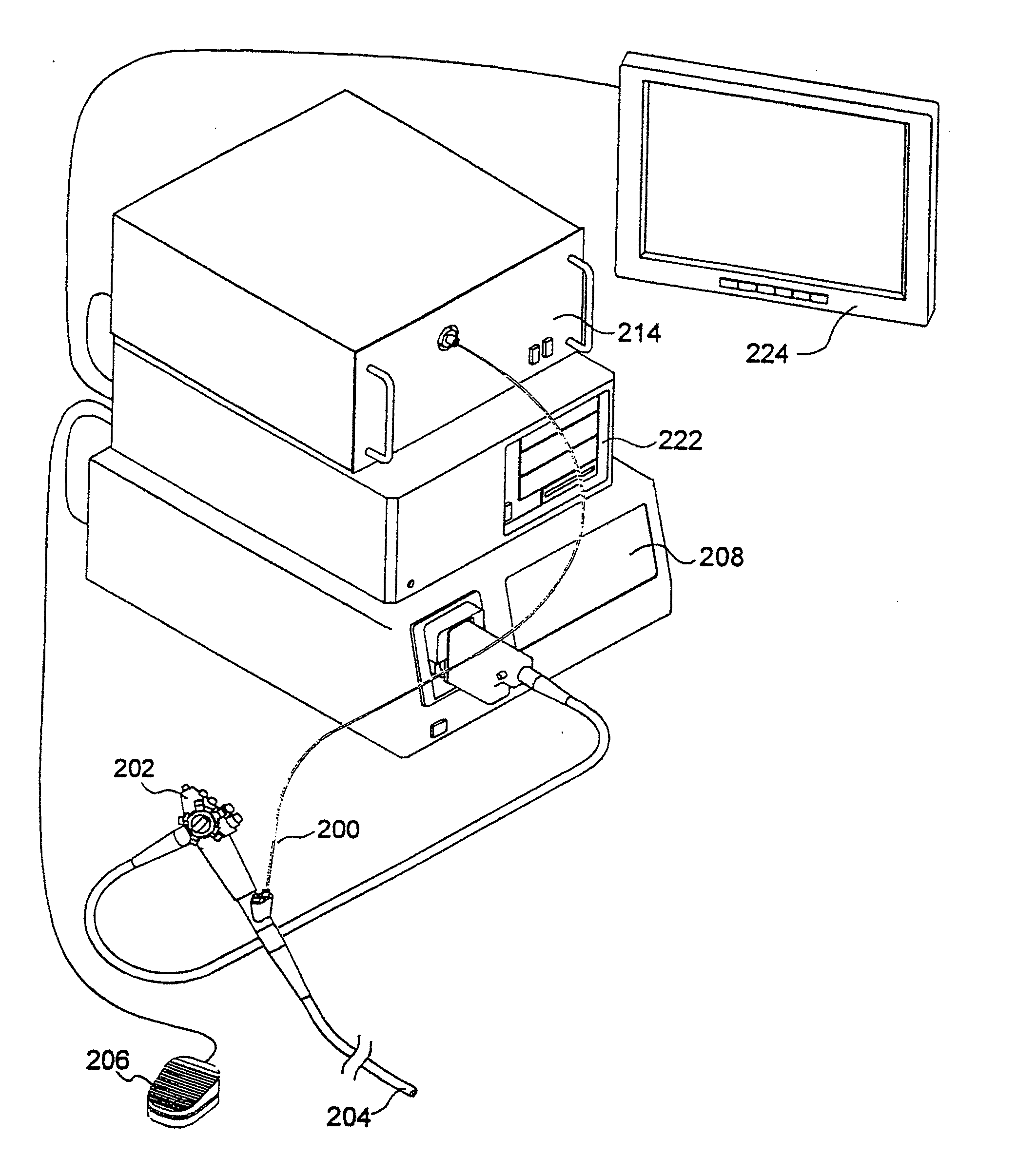 Autofluorescence imaging system for endoscopy