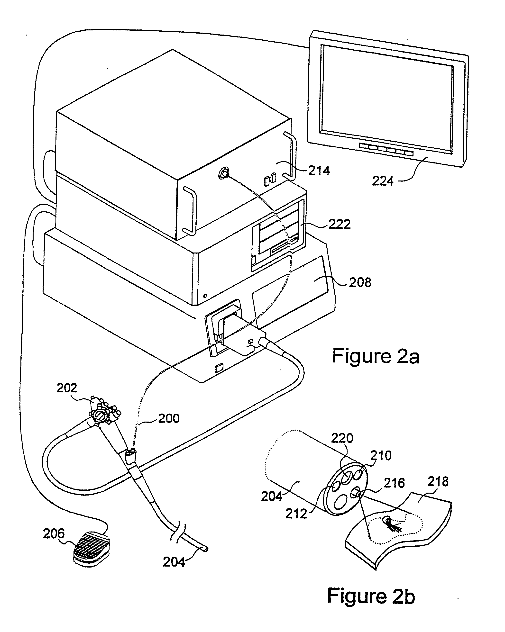 Autofluorescence imaging system for endoscopy