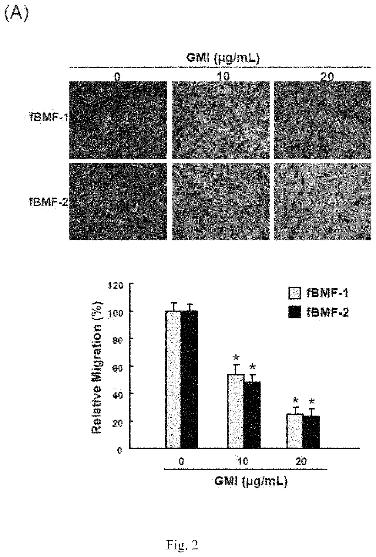 Use of immunomodulatory protein from <i>Ganoderma </i>in inhibiting fibrosis