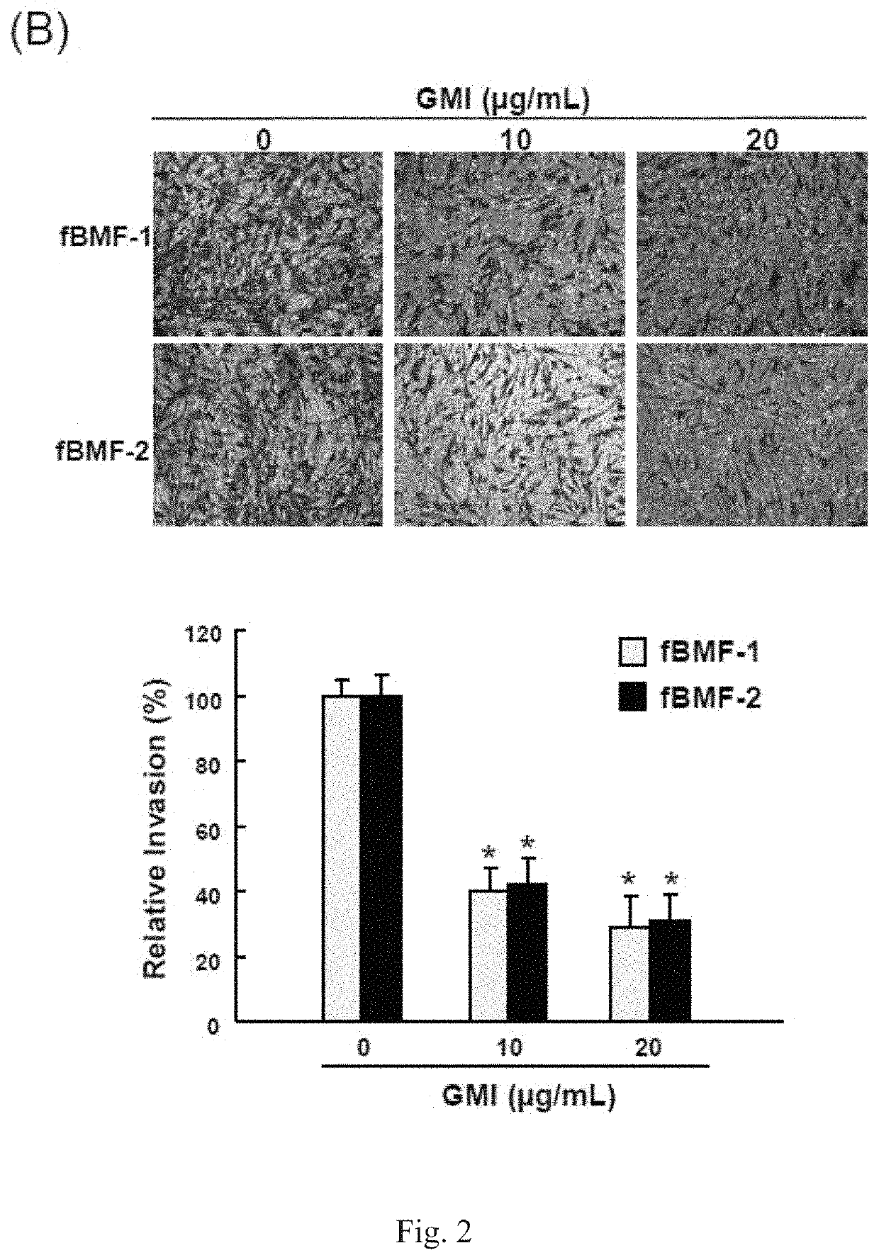 Use of immunomodulatory protein from <i>Ganoderma </i>in inhibiting fibrosis