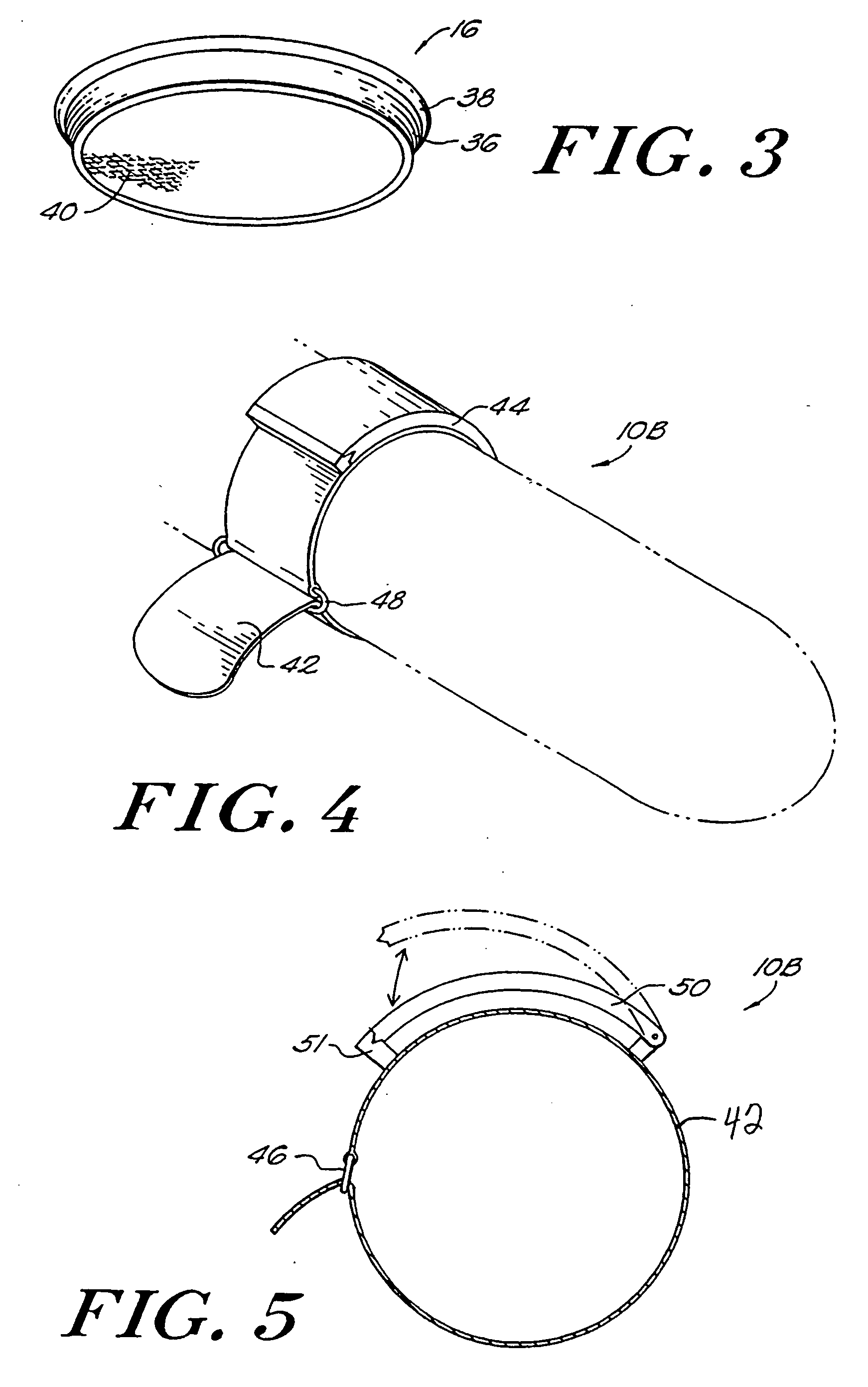 Ultrasound-mediated drug delivery