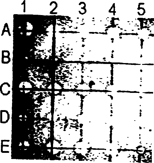 Killer cell antibiosis polypeptide activated by lymphokine and its application