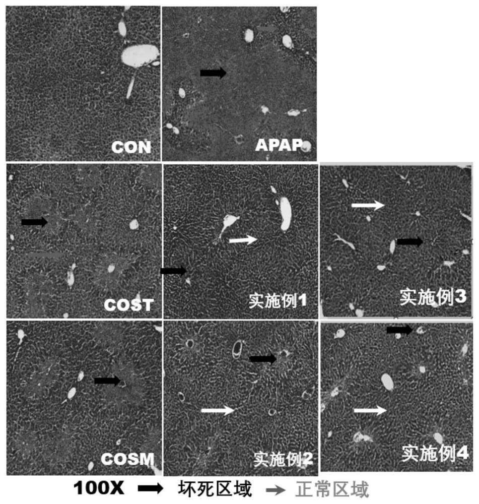 Chitosan oligosaccharide composition and preparation method and application thereof