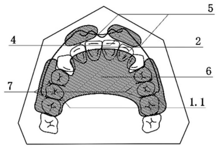 Maxillary occlusal pad-lip shield appliance