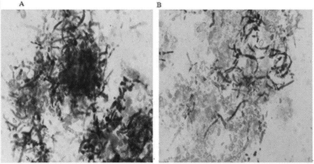 Method of preparing lycopene and lycopene product