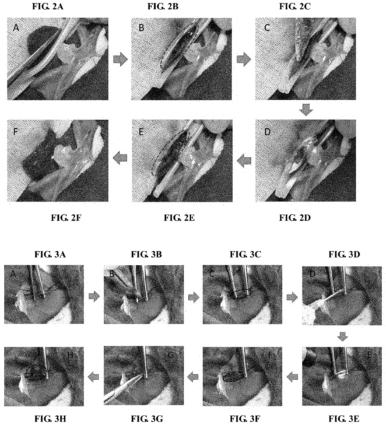 Agent for biological damage repair or hemostasis and the method thereof