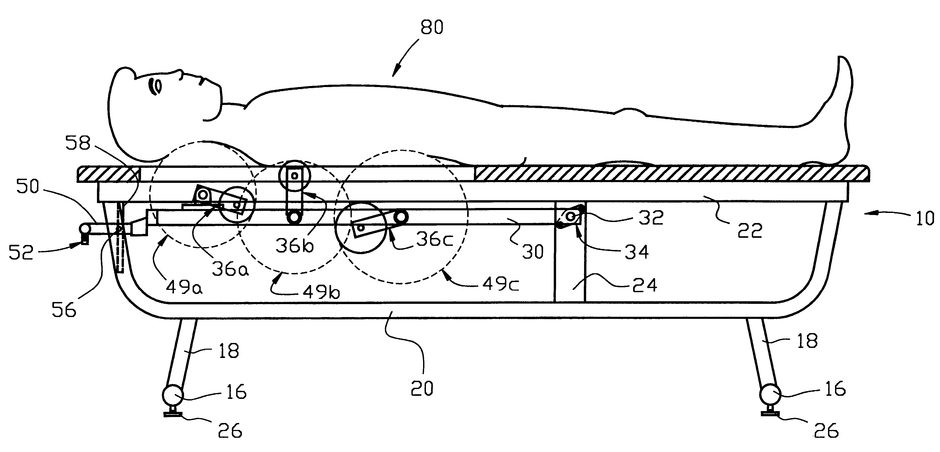 Therapeutic massage table