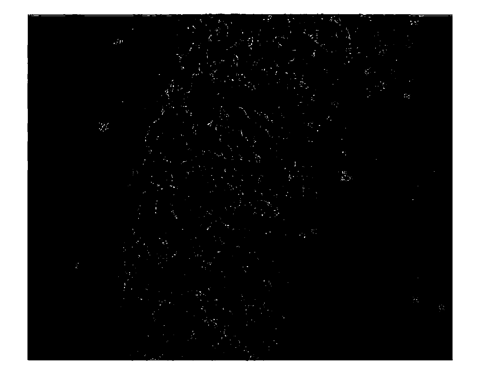 Decellularization method for preparing extracellular matrix (ECM) support material