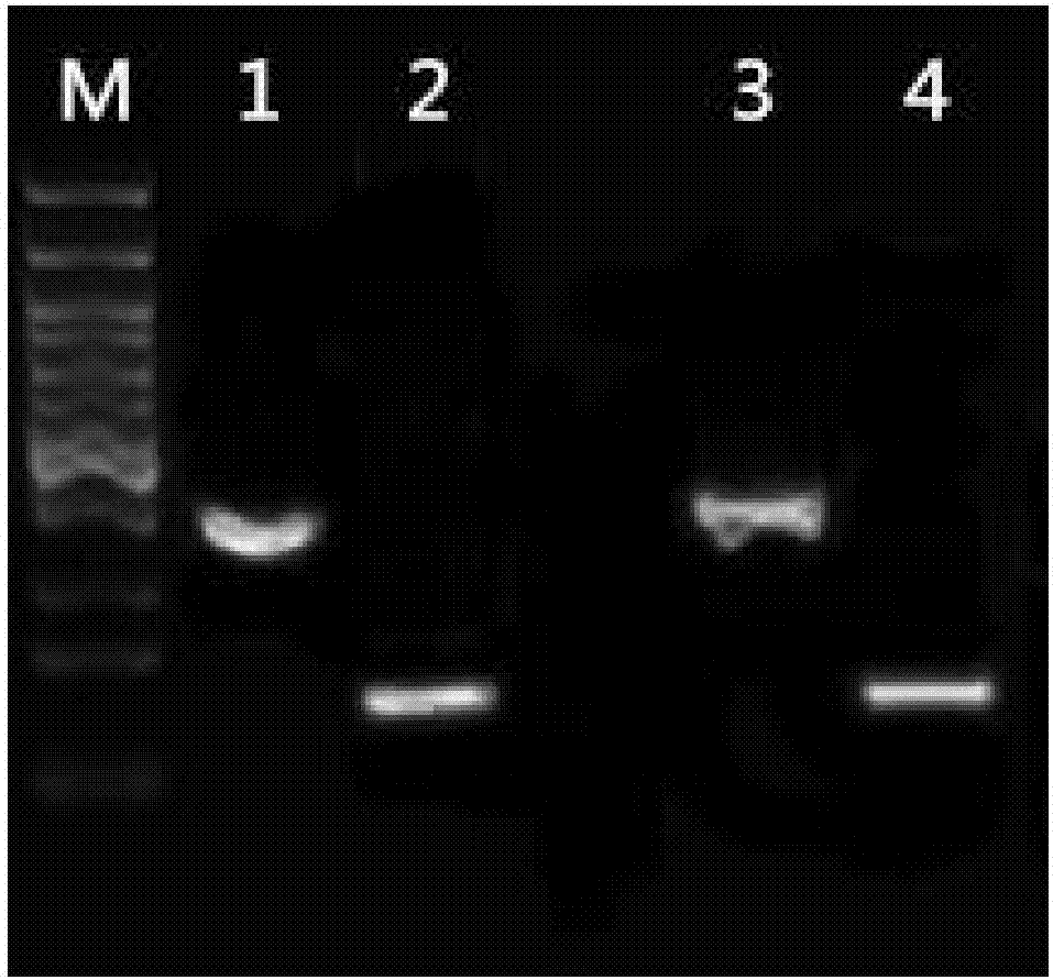 Method for detecting polymorphism of folate metabolism related genes through whole-blood direct nucleic acid amplification