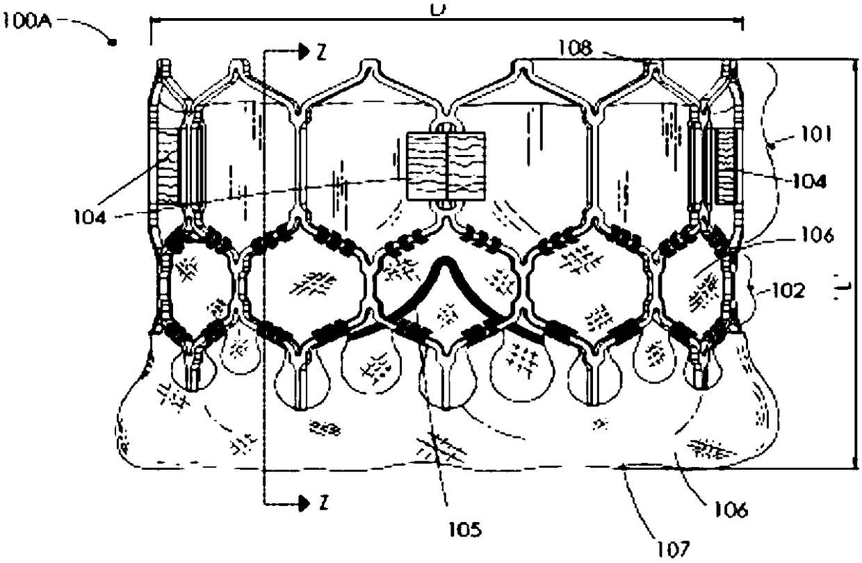 Prosthetic valve