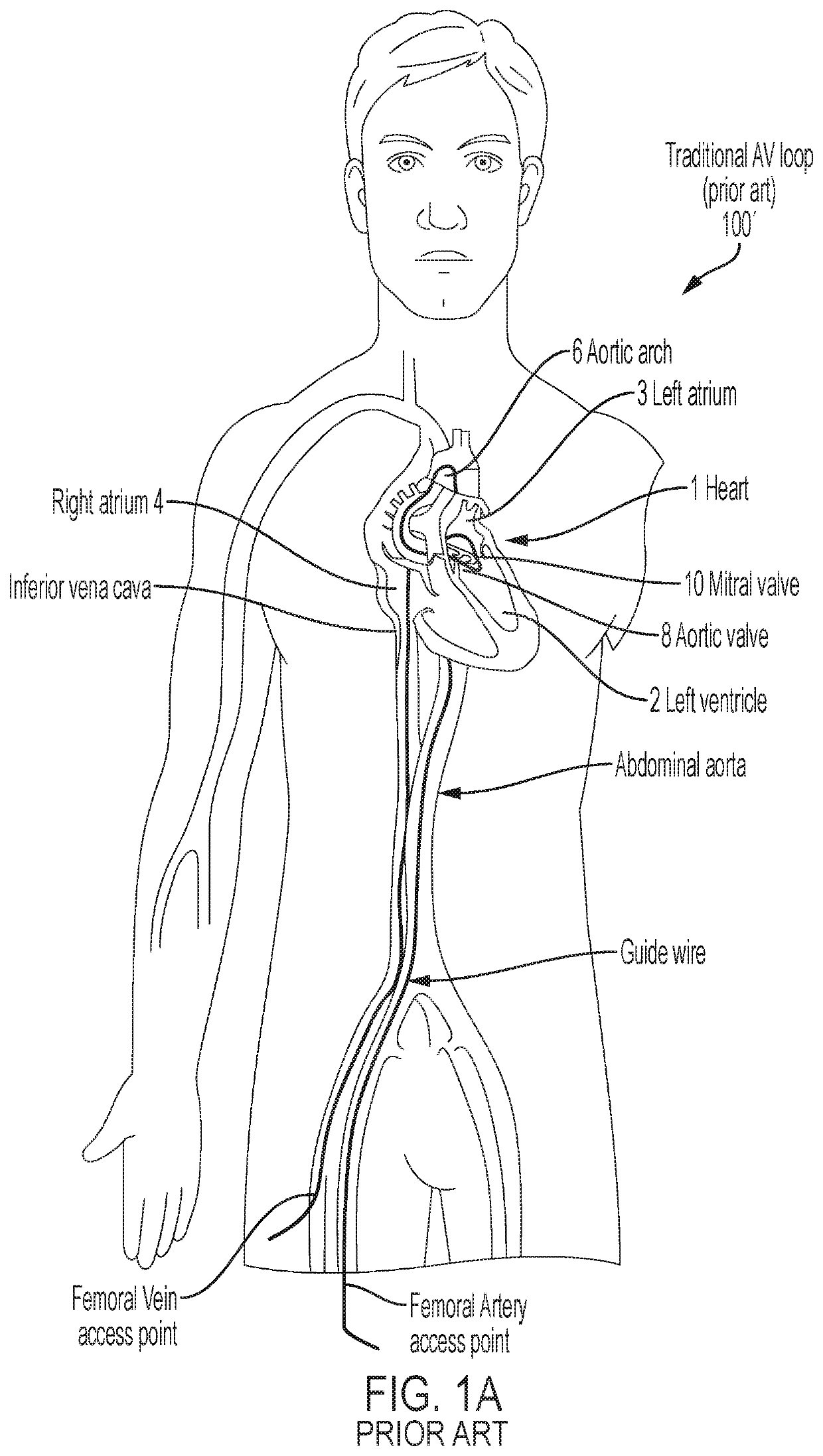 Apparatus And Methods For Delivery Of Prosthetic Heart Valves