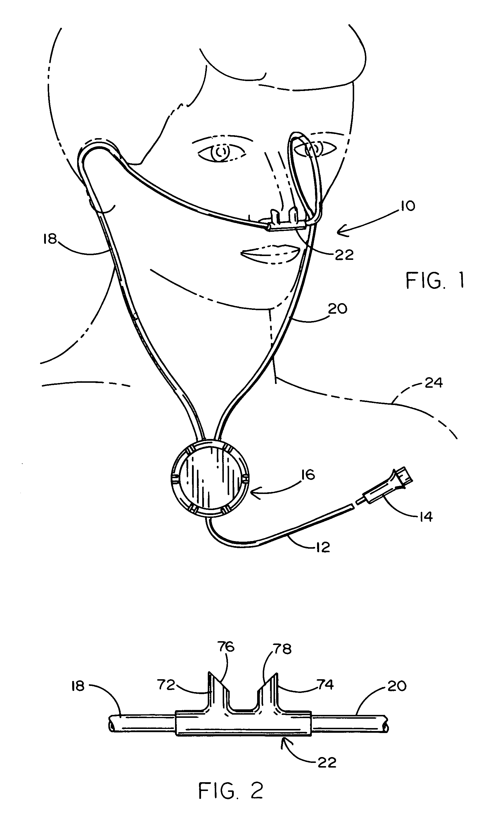 Oxygen delivery cannula system that improves the effectiveness of alveolar oxygenation