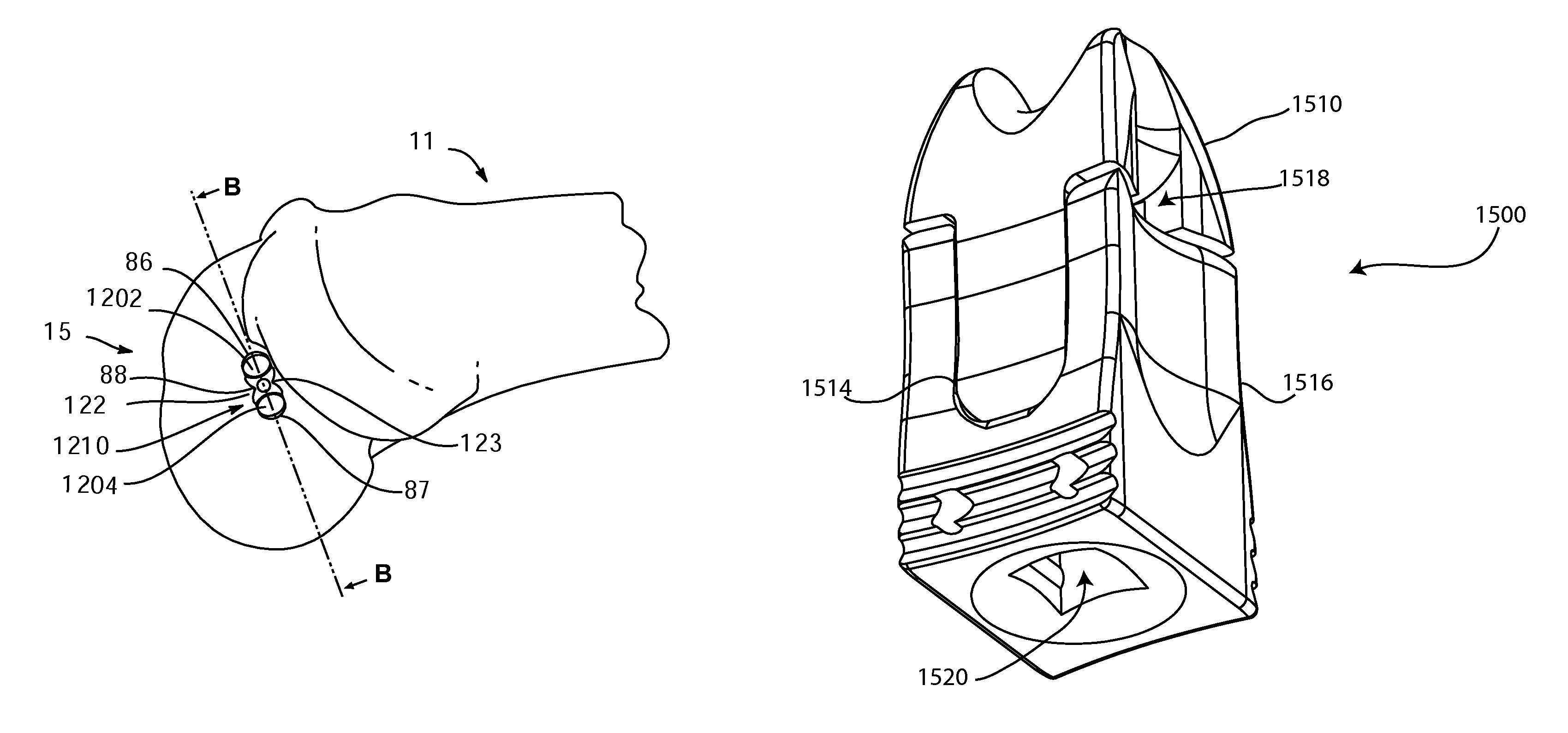 Double bundle ACL repair system