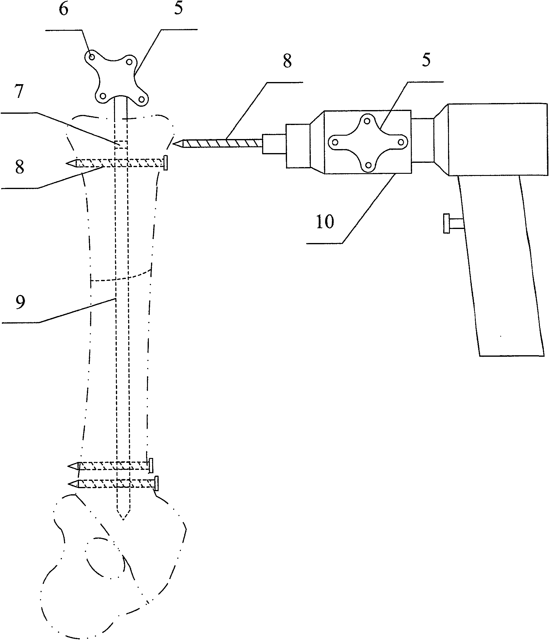 Orthopaedics operation navigation system