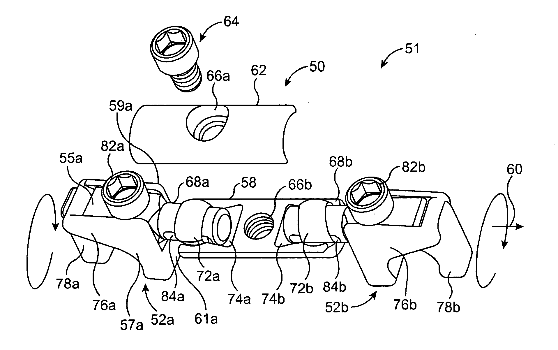 Systems and methods for posterior dynamic stabilization of the spine