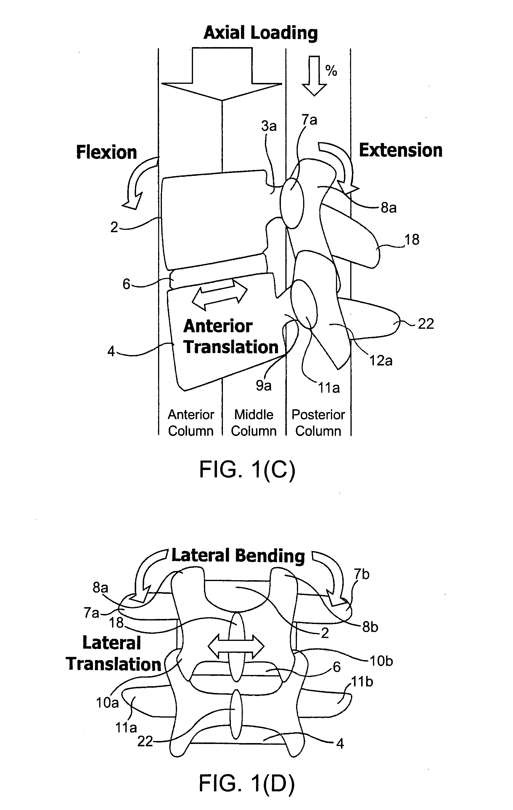 Systems and methods for posterior dynamic stabilization of the spine