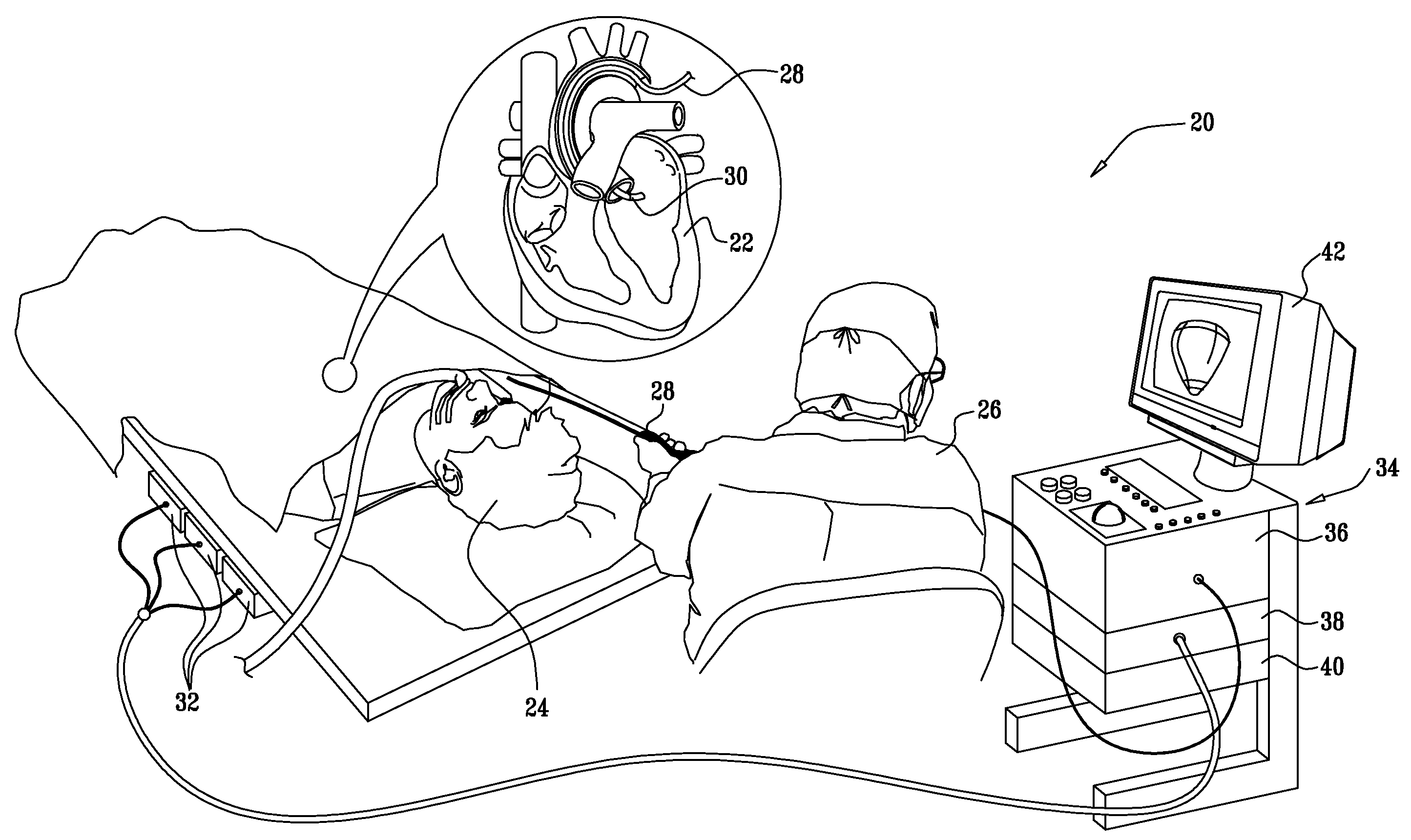 Catheter display showing tip angle and pressure