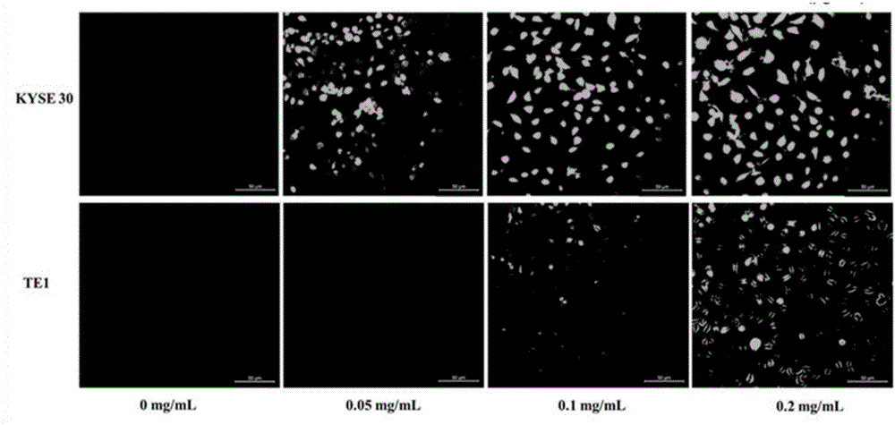 Tumor tissue in-vitro pathological staining kit