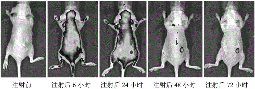 Tumor tissue in-vitro pathological staining kit