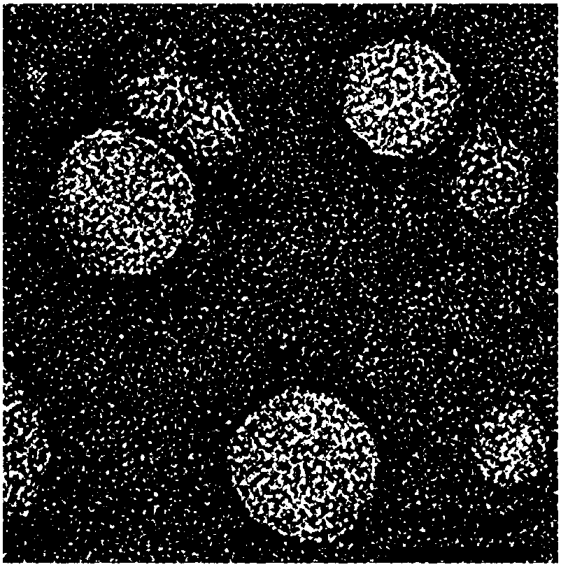 Nano preparation for improving stability of enzyme drugs and preparation method and application of nano preparation