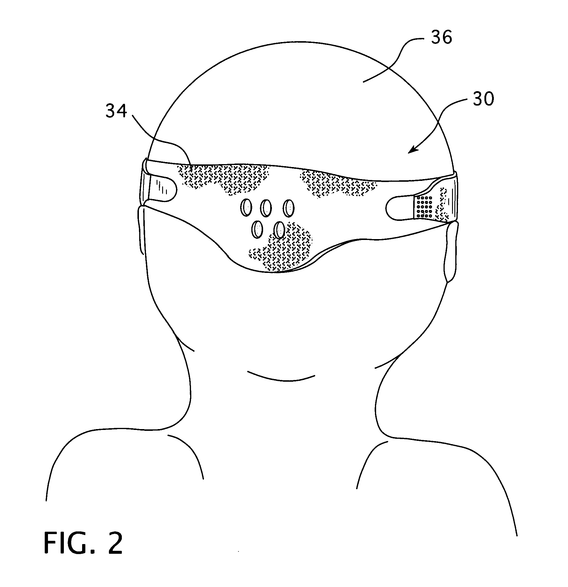 Molded phototherapy goggles