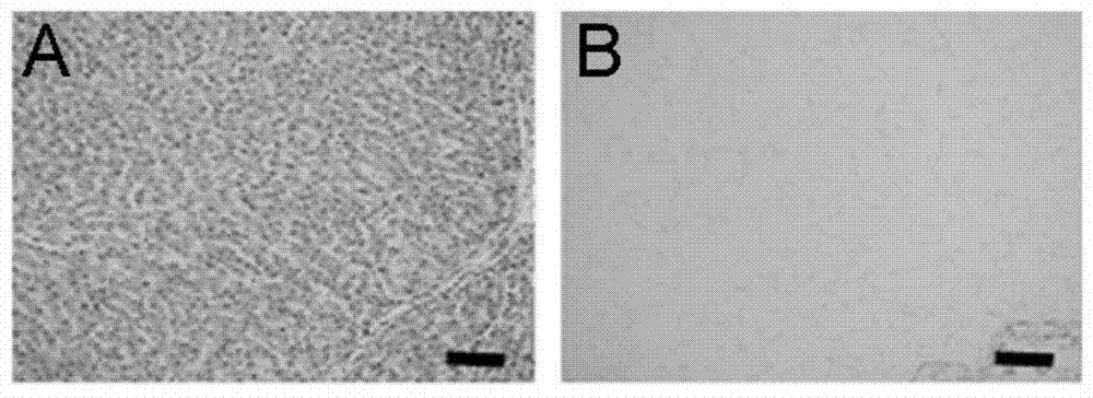 Cellularization biological liver stent with anticoagulation property and preparation method of cellularization biological liver stent