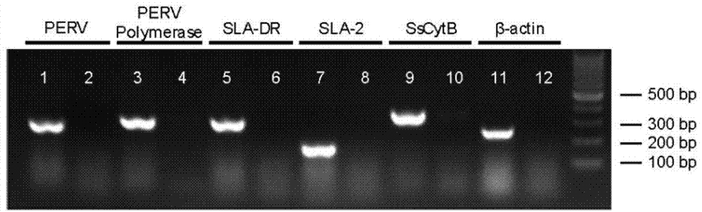 Cellularization biological liver stent with anticoagulation property and preparation method of cellularization biological liver stent