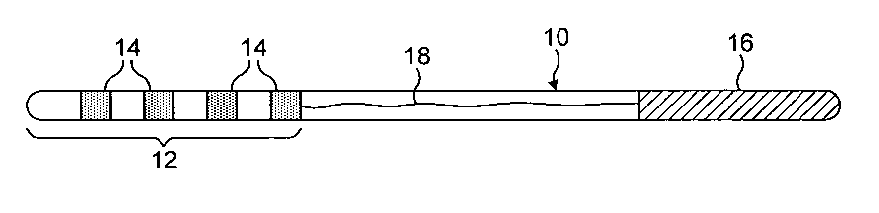 Peripheral neurostimulation