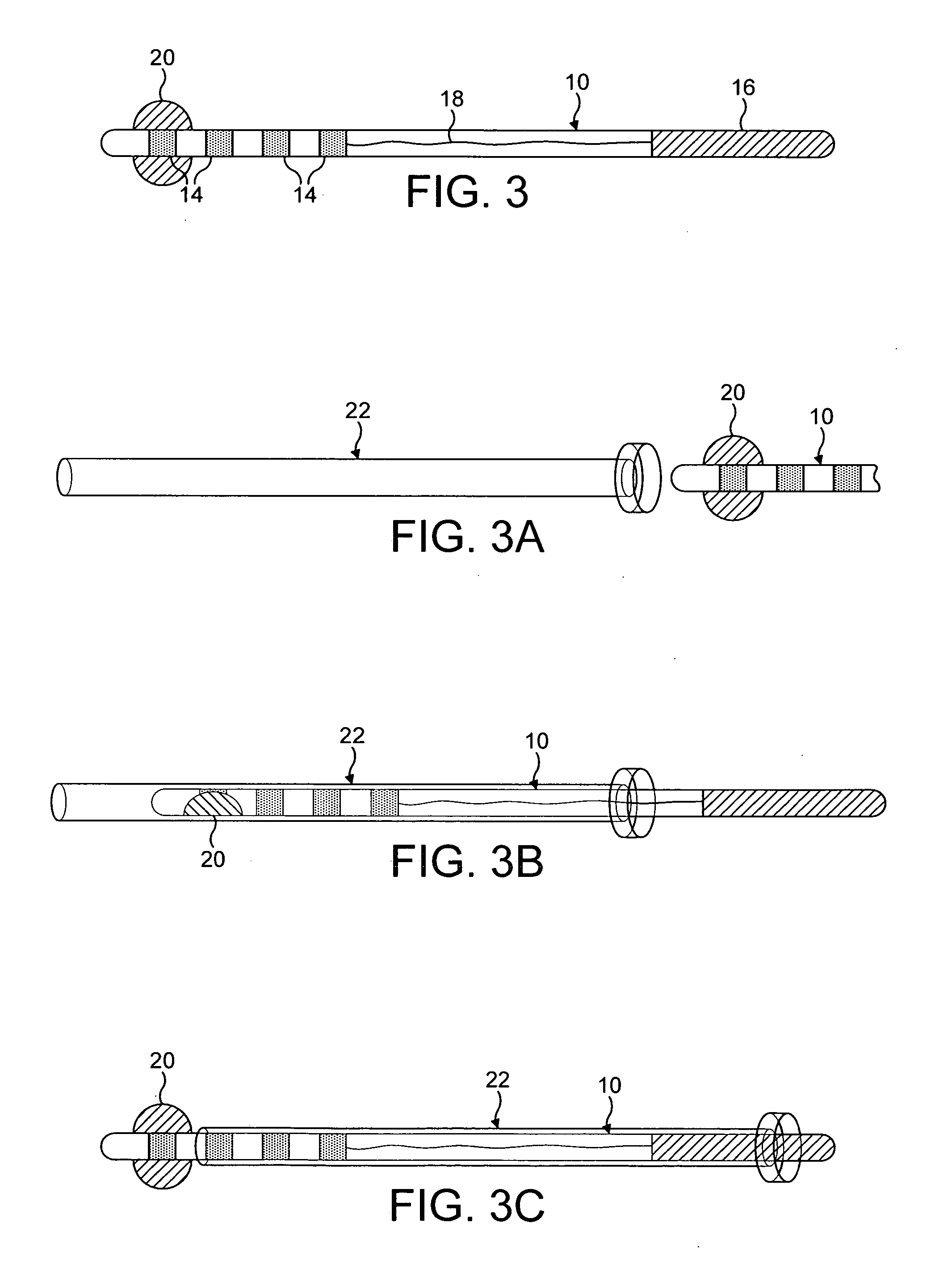 Peripheral neurostimulation