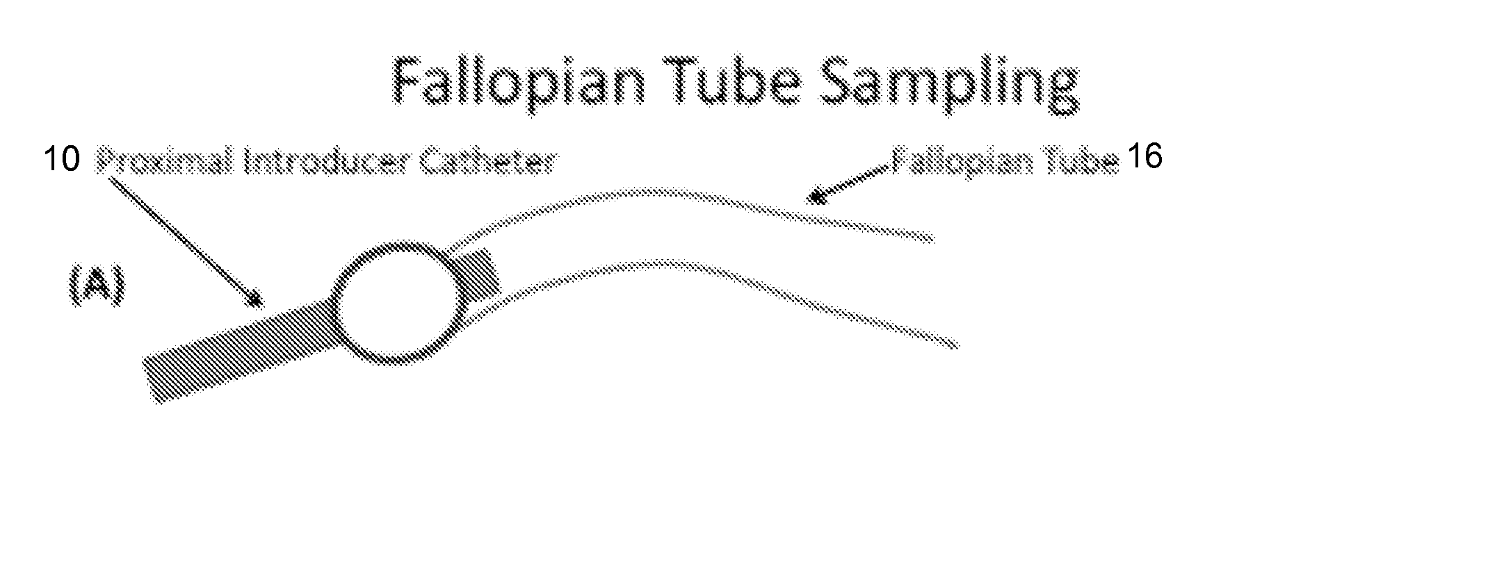 Methods and devices for fallopian tube diagnostics