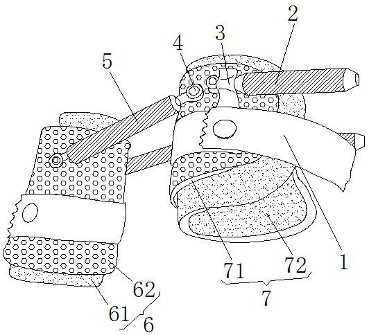 Extending fixing support frame for closed reduction surgery of supracondylar fracture of humerus in children