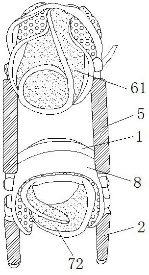 Extending fixing support frame for closed reduction surgery of supracondylar fracture of humerus in children