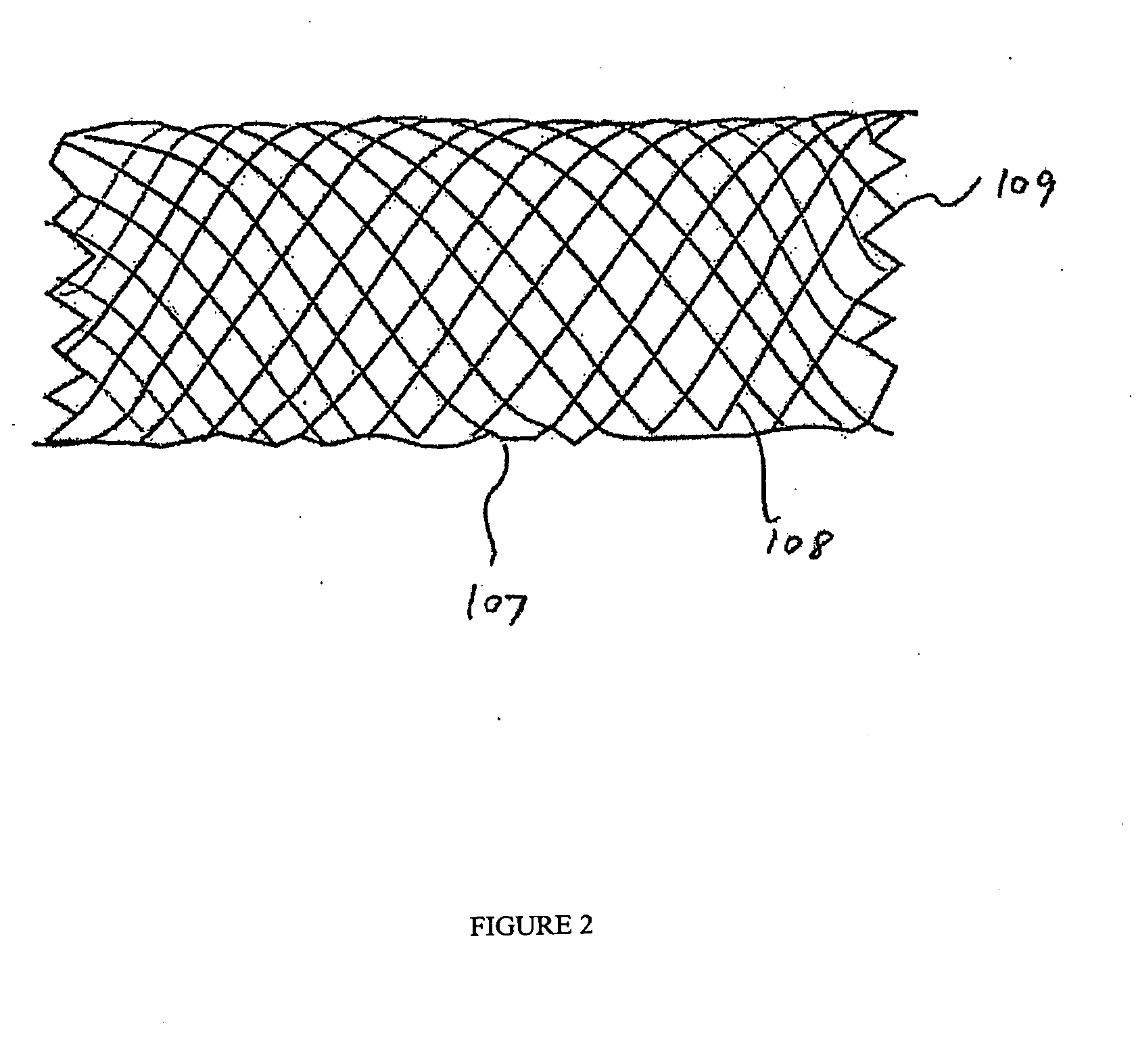 Endovascular device with membrane