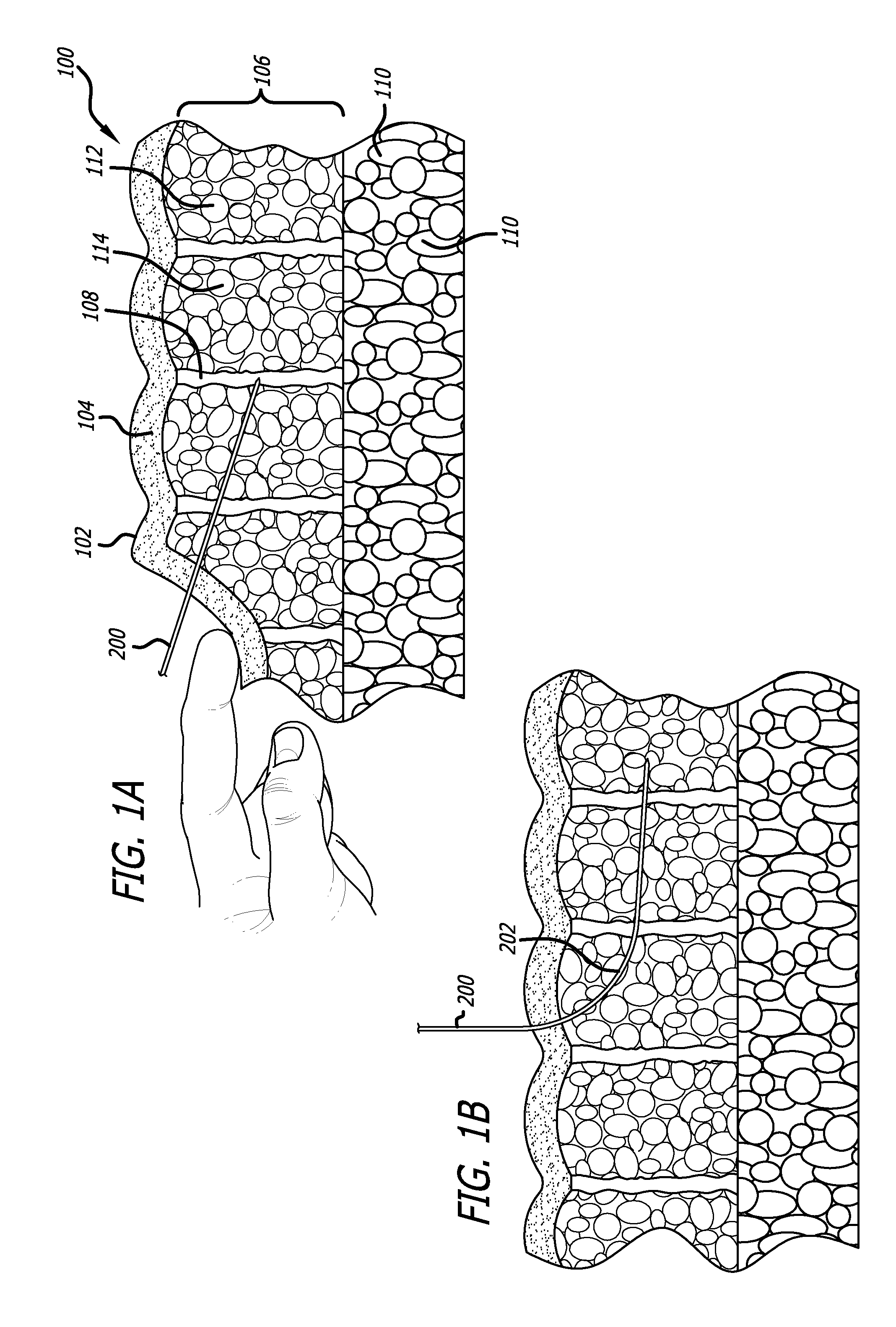 High pressure pre-burst for improved fluid delivery