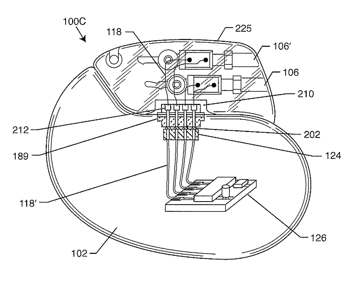 Hermetically sealed filtered feedthrough assembly having a capacitor with an oxide resistant electrical connection to an active implantable medical device housing