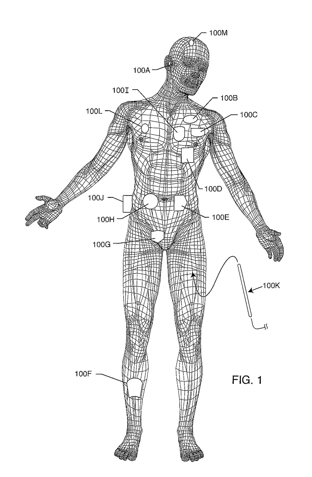 Hermetically sealed filtered feedthrough assembly having a capacitor with an oxide resistant electrical connection to an active implantable medical device housing