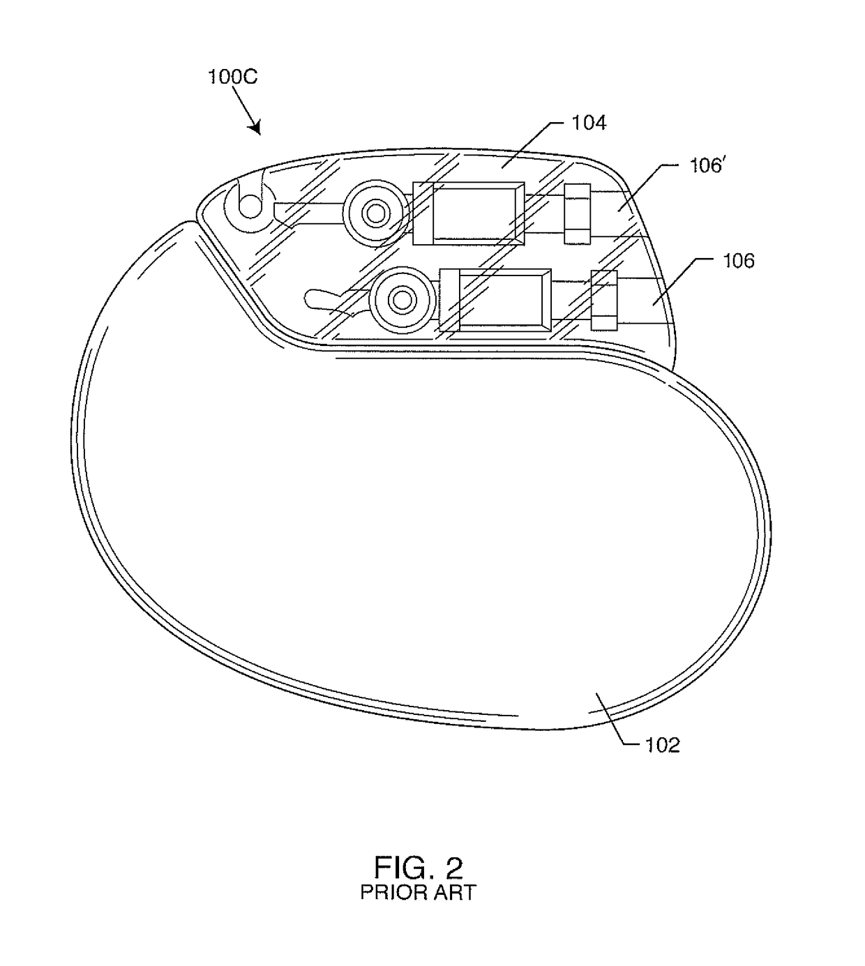 Hermetically sealed filtered feedthrough assembly having a capacitor with an oxide resistant electrical connection to an active implantable medical device housing